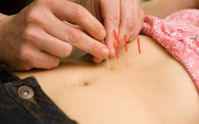 Acupuncture for Fertility Support